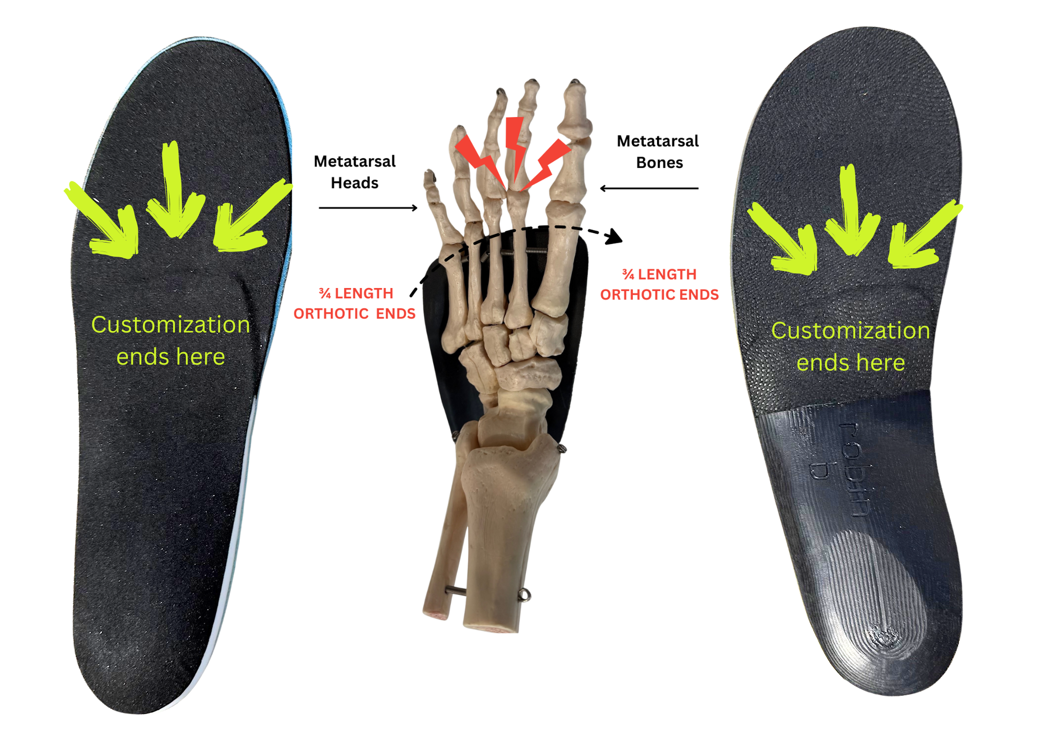 Diagram by Texas Foot Orthotics comparing standard ¾-length orthotics to full-length custom orthotics. The image shows two insoles labeled ‘Customization ends here’ and a foot skeleton in the center highlighting the metatarsal bones and where ¾-length orthotics stop, demonstrating how typical orthotics fail to support the entire foot