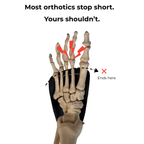Custom Foot Orthotics with Impression Kit