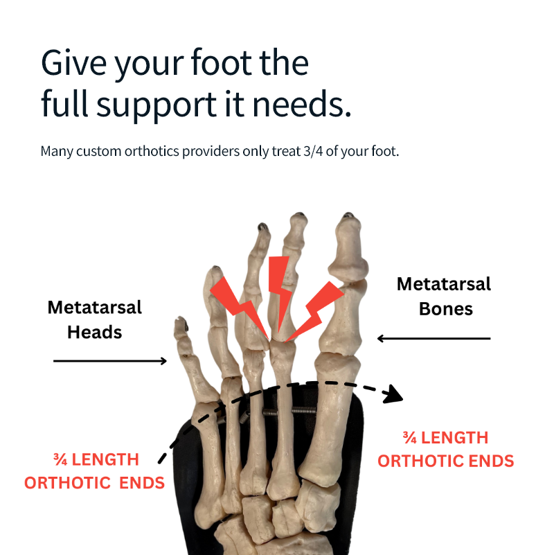 Custom Foot Orthotics