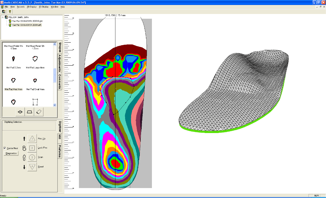 Screenshot of specialized orthotic design software displaying a 3D model of a custom foot pad, illustrating full-foot support from heel to toe for perfect fit, comfort, balance, and lasting relief